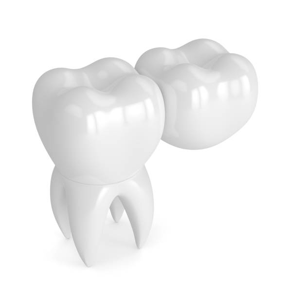 istock 3d render of teeth with dental cantilever bridge 931097034