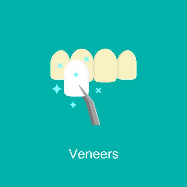歯科材突き板。歯科医療機器記号。 - veneer点のイラスト素材／クリップアート素材／マンガ素材／アイコン素材