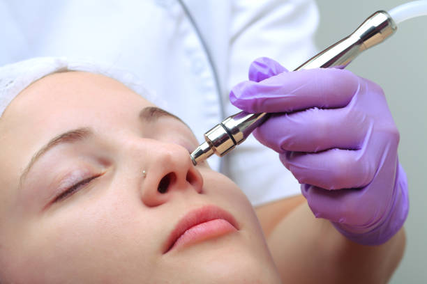 istock Diamond microdermabrasion, peeling cosmetic. woman during a microdermabrasion treatment in beauty salon 931131276