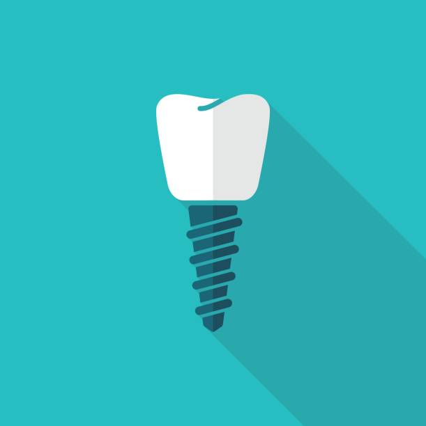 illustrations, cliparts, dessins animés et icônes de un implant dentaire. illustration vectorielle - dentist symbol human teeth healthcare and medicine