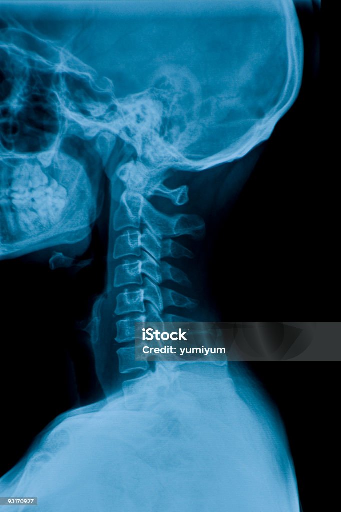 X-선 영상 네클 - 로열티 프리 X-레이 스톡 사진