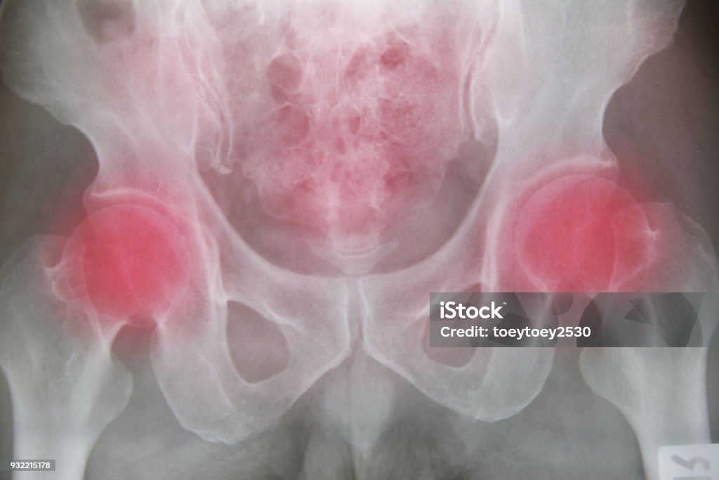X ray film on red filter medical science background. Anatomy Stock Photo