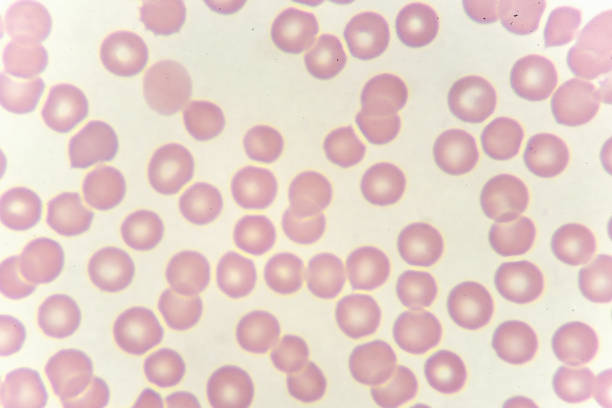 istock Red blood cells in blood smear 932390412