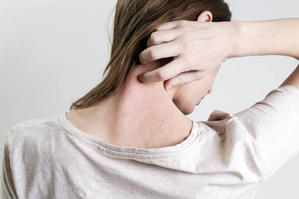Close up view of woman scratching her neck. Close up view of woman scratching her neck. skin inflammation stock pictures, royalty-free photos & images