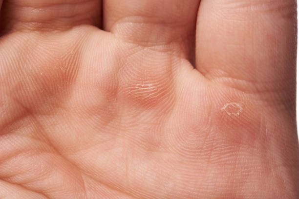 Man showing his hand with callus