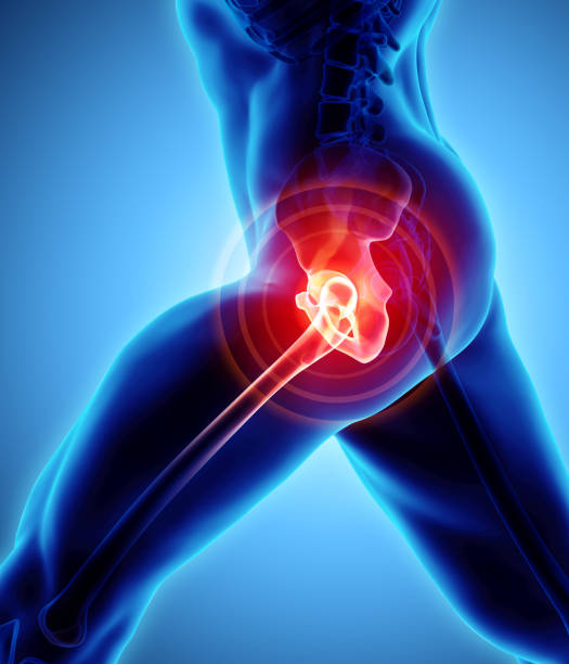 istock Hip painful skeleton x-ray, 3D illustration. 933150652