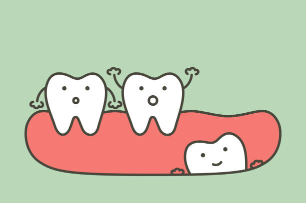 266 Wisdom Teeth Illustrations & Clip Art - iStock | Surgery, Dental implants, Wisdom teeth surgery 266 Wisdom Teeth Illustrations & Clip Art - iStock | Surgery, Dental implants, Wisdom teeth surgery