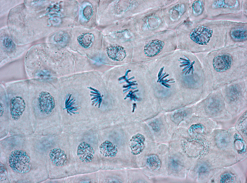Squash preparation of plant cells stained to reveal chromosomes, various stages of mitosis are visible. Bright field illumination, light microscopy. This image was taken with the X40 objective lens. Depth of focus is extremely low at this magnification. Smaller apertures give greater depth of focus, but image quality deteriorates and resolution is greatly reduced. The aperture in this image was optimised for contrast and resolution. Chromatic aberration is inevitable in light microscopy, but has been kept to a minimum in this image.