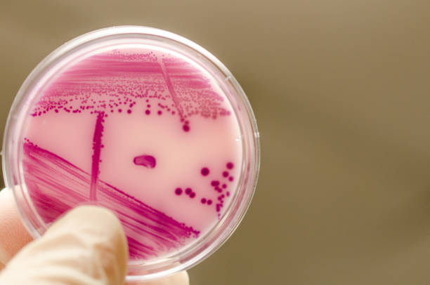 istock Bacterial culture plate 933957428