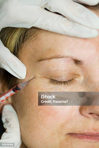 Injeção De Botox - Fotografias de stock e mais imagens de Adulto - Adulto, Adulto de idade mediana, Anestésico