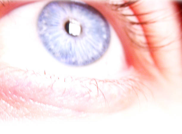 istock Giving You The Eye 93435795