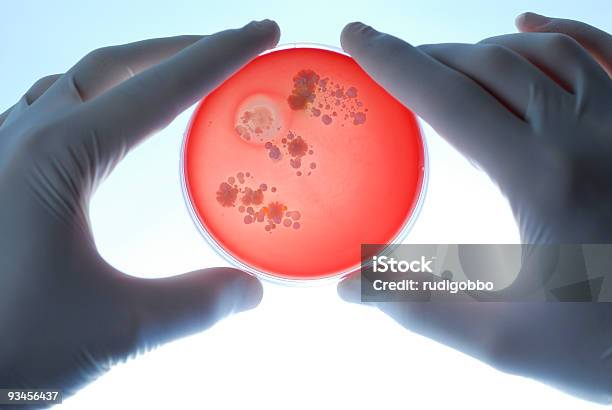 연구자 쥠 유혈 한천 플레이트 박테리아에 대한 스톡 사진 및 기타 이미지 - 박테리아, 군체, 재배 식물