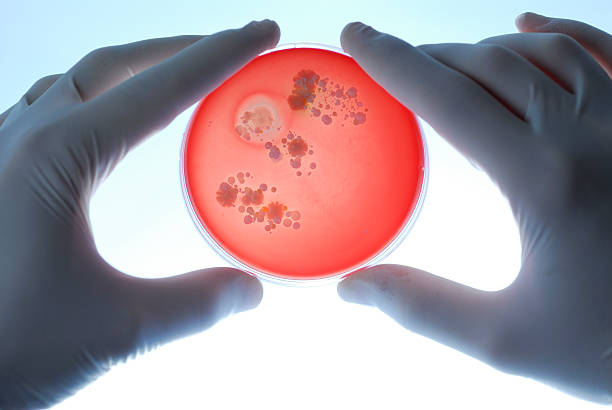 Researcher holding blood agar plate stock photo