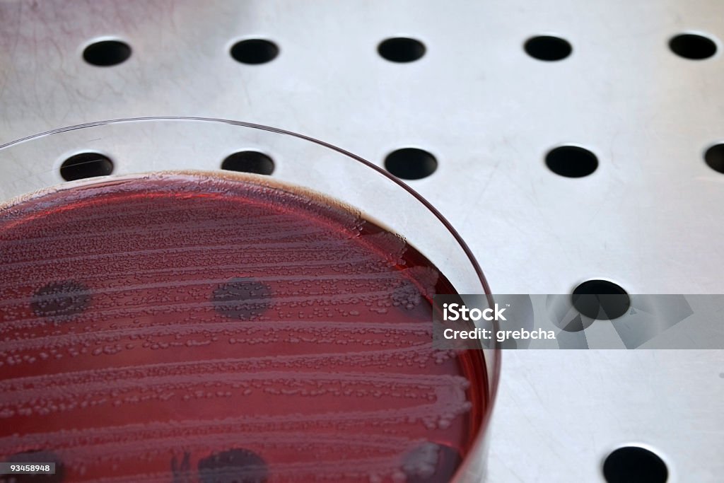 Placa de Petri con bacterias - Foto de stock de Acero libre de derechos