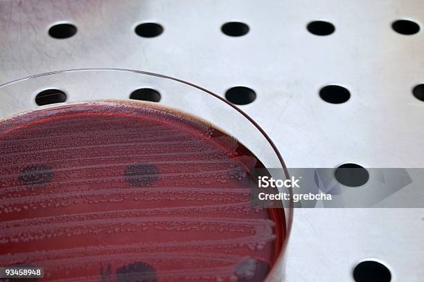 Placa De Petri Con Bacterias Foto de stock y más banco de imágenes de Acero - Acero, Acero inoxidable, Agar-agar