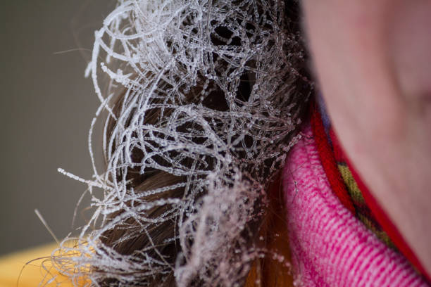 istock Funny women's braid - covered with hoarfrost on frosty winter day 934785430