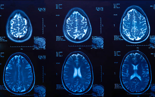 skan mri mózgu w badanie lekarskie - mri scanner healthcare and medicine medical exam brain zdjęcia i obrazy z banku zdjęć