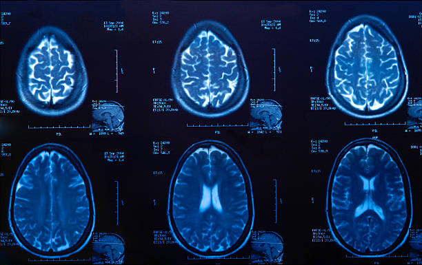 мрт-сканирование головного мозга для медицинский осмотр - brain mri scanner mri scan medical scan стоковые фото и изображения