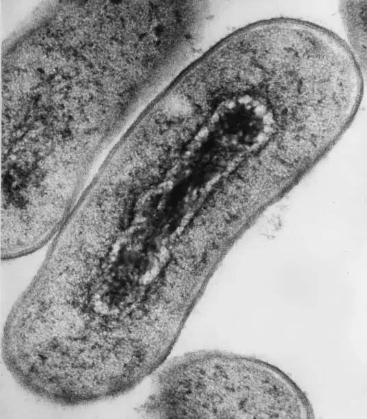 Cross section of Escherichia coli bacteria
