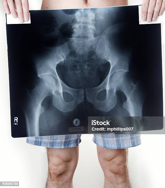 Boden Röntgenbild Stockfoto und mehr Bilder von Boxershorts - Boxershorts, Daten, Erwachsene Person