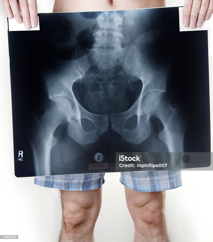 Inflammation x-ray image - Photo de Adulte libre de droits