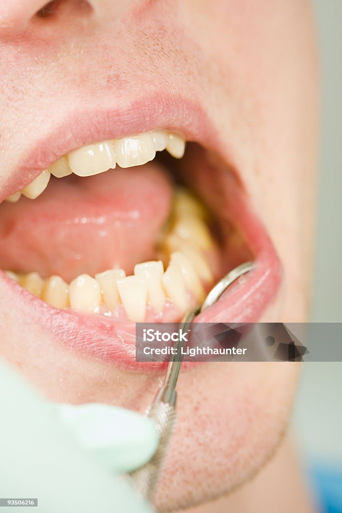 Congestioned dents - Photo de Adulte libre de droits