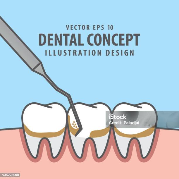 Square Banner Scaling Teeth Illustration Vector On Blue Background Dental Concept Stock Illustration - Download Image Now