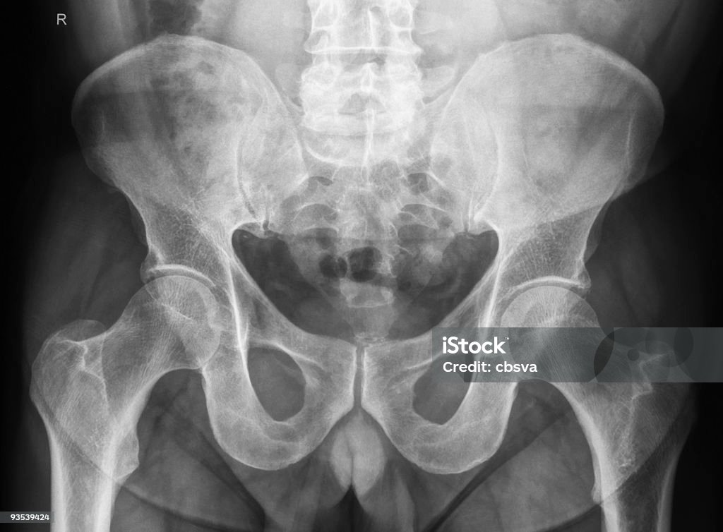 Mâle bassin X-Ray - Photo de Personne humaine libre de droits