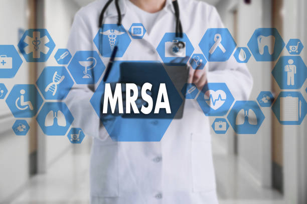 istock Medical Doctor with stethoscope and word MRSA ,Methicillin-Resistant Staphylococcus Aureus in Medical network connection on the virtual screen on hospital background.Technology and medicine concept. 935395154