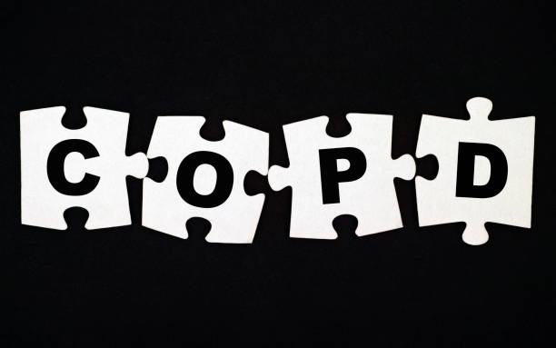 istock Four pieces of puzzle with letters COPD on black background. 935471618