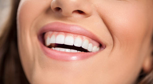 istock Smiling woman with healthy teeth 935533654