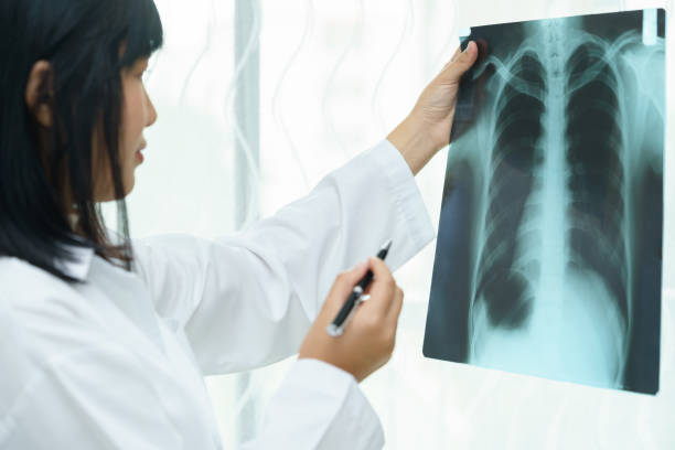 Female doctor examining about lungs with x-ray film - sick concept stock photo