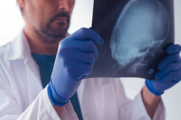 istock Doctor examining x-ray of the patient's skull 936129932
