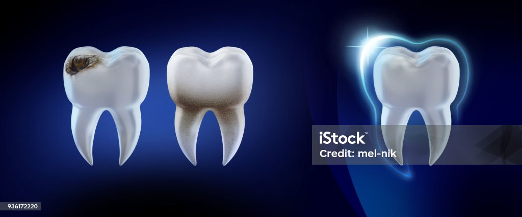 Dental concept. 3d render illustration clean and dirty tooth isolated on blue, clearing tooth process. Teeth Whitening. Oral Care, teeth restoration. Dental background Three Dimensional Stock Photo