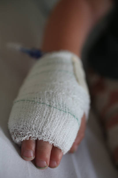 istock A close up of a boys hand with a IV drip in. 936551912