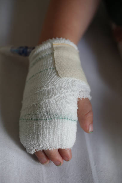 istock A close up of a boys hand with a IV drip in. 936551920