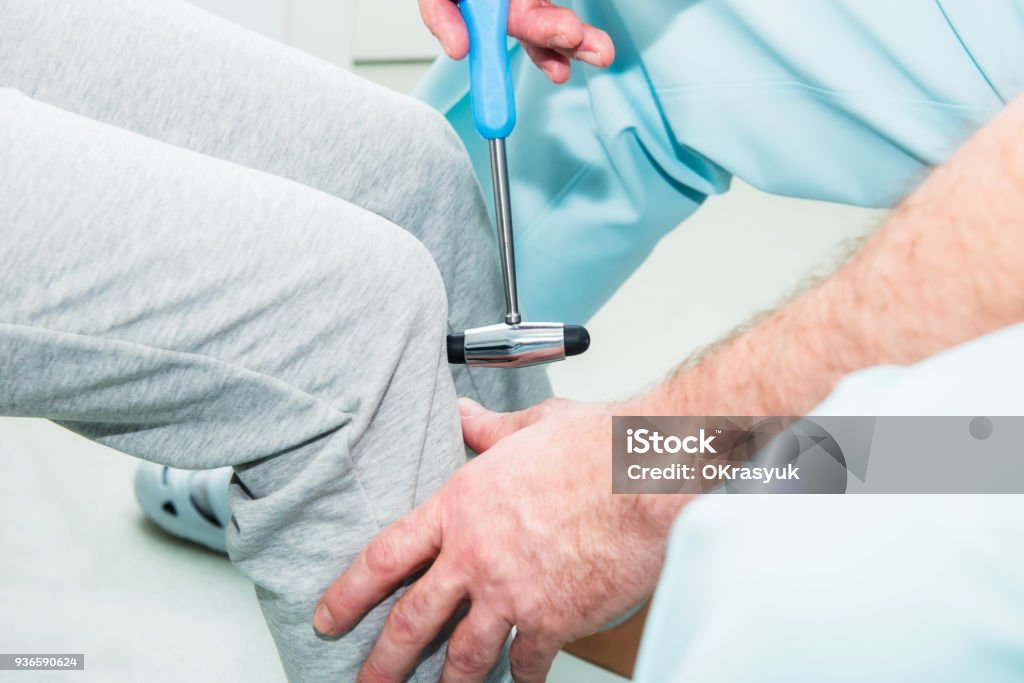 Der Neurologe testen Knie Reflex auf eine Patientin mit einem Hammer. Neurologische körperliche Untersuchung. Tiefenschärfe, Nahaufnahme. - Lizenzfrei Arzt Stock-Foto