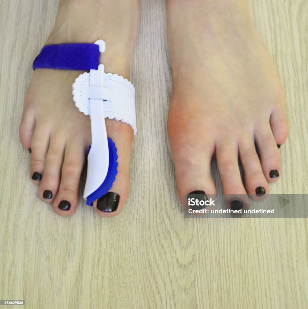 feet wearing hallux valgus orthopedic pads on thumb toes Woman standing on the floor with orthopedic pads on feet Anatomy Stock Photo