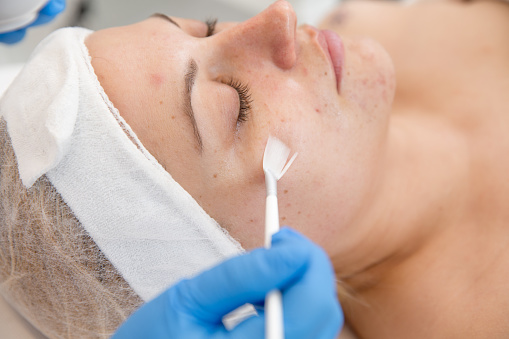 Adulto mujer recibe el tratamiento de peeling químico la piel en el dermatólogo photo