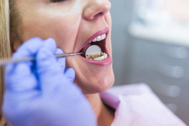 istock Open female mouth during oral checkup at the dentist. Selective 937286552