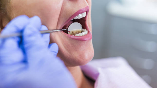 Open female mouth during oral checkup at the dentist. Selective stock photo