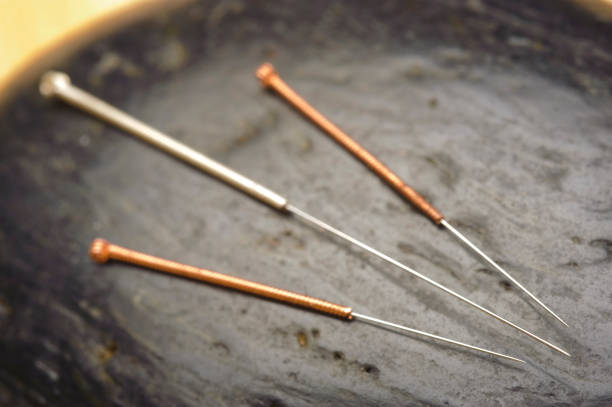 alternative medicine with acupuncture
