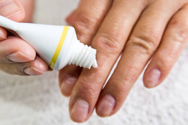 istock Cream close up on hand in a blur . 937450356