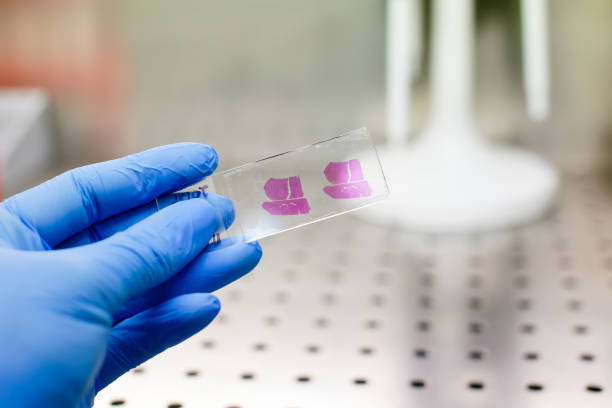 istock Hand in blue glove with histological liver tissue sample 937571342