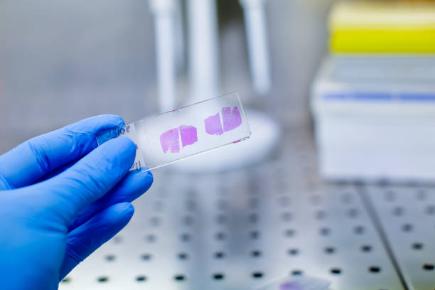 istock Hand in blue glove with histological liver tissue sample 937571394