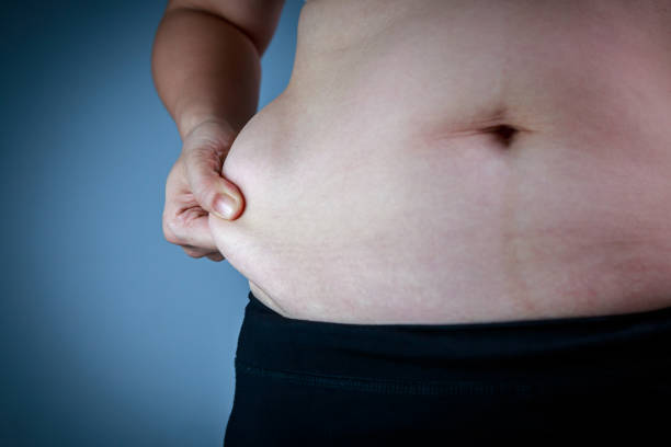 istock Close up female checking fat on abdomen, dark blue background. 937628034