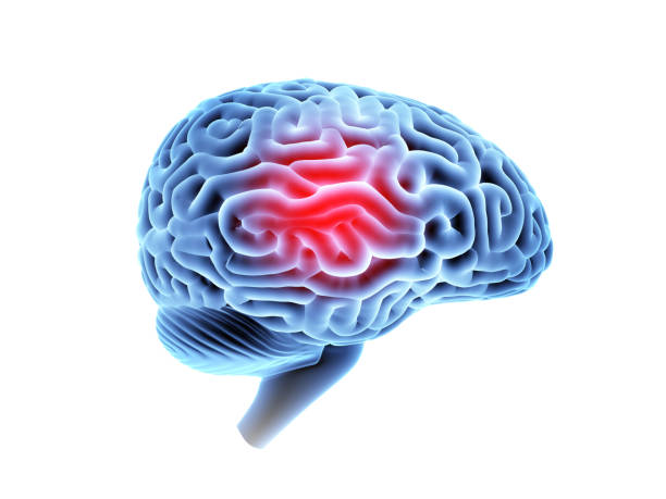 cérebro de ressonância magnética com dor de cabeça. - mri scan human nervous system brain medical scan - fotografias e filmes do acervo