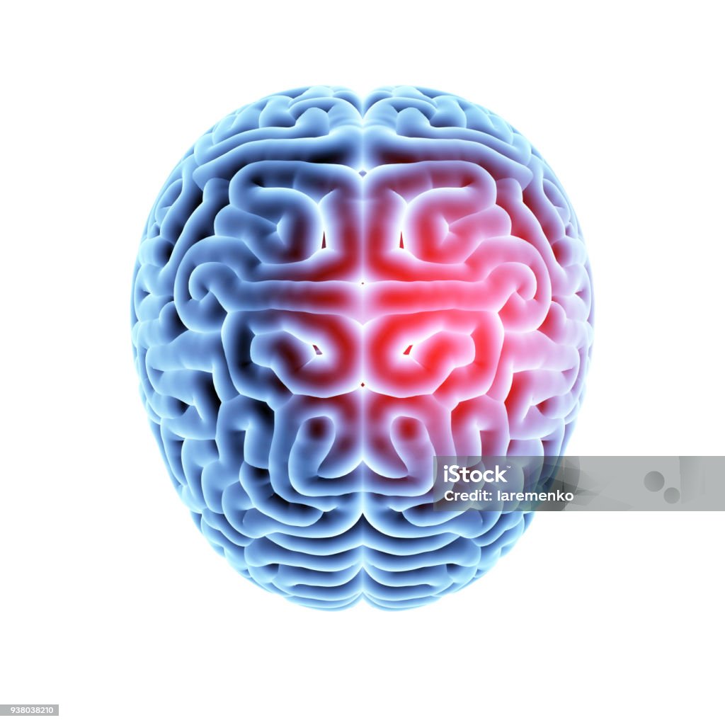 Mri brain with headache. Headache area on brain X-ray, top view isolated on white background. 3D illustration. Shock Stock Photo