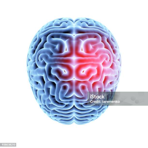 Mri Brain With Headache Stock Photo - Download Image Now - Shock, Concussion, Anatomy