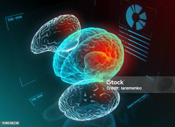 Concepto De Medicina Futurista Foto de stock y más banco de imágenes de Escán médico - Escán médico, Enfermedad de Alzheimer, Imagen de resonancia magnética